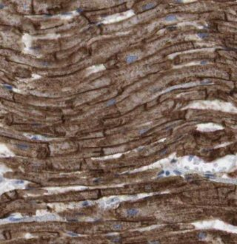 GUCY1A1 Antibody