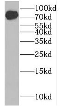GUSB Rabbit Polyclonal Antibody