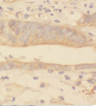 GUSB Rabbit Polyclonal Antibody