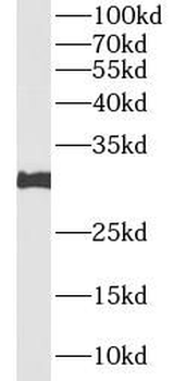 GZMB Rabbit Polyclonal Antibody