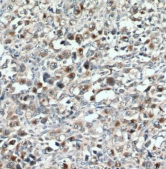 GZMB Rabbit Polyclonal Antibody