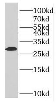 GZMM Rabbit Polyclonal Antibody