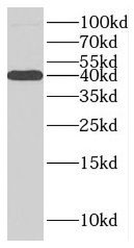 MACROH2A2 Rabbit Polyclonal Antibody