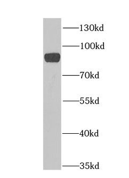 H6PD Antibody