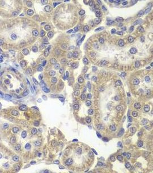 H6PD Antibody
