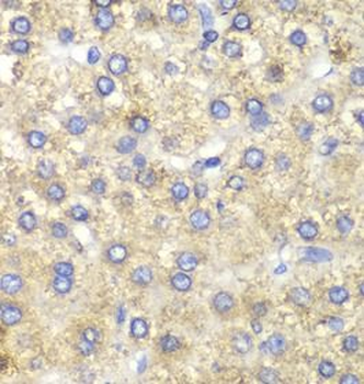 HADH Antibody