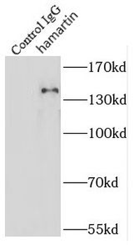 TSC1 Antibody