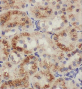 TSC1 Antibody