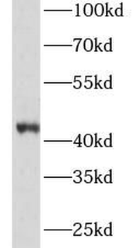 HP Rabbit Polyclonal Antibody