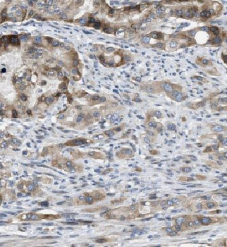 USH1C Antibody