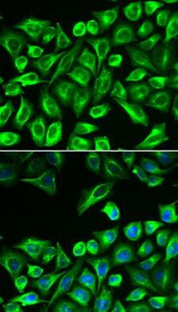 HAS3 Antibody