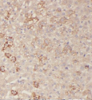 HAS3 Antibody