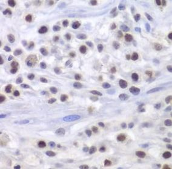 HAT1 Antibody