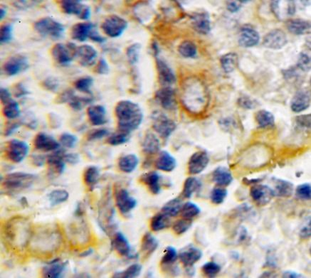 HAX1 Antibody