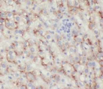 HBB Antibody