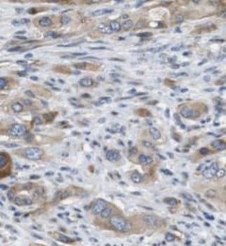 HBS1L Antibody