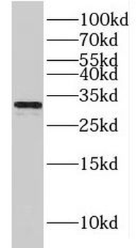 HCCS Rabbit Polyclonal Antibody
