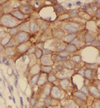 HCCS Rabbit Polyclonal Antibody