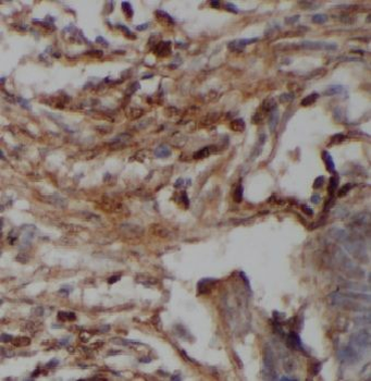 HCFC1 Antibody