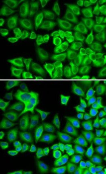 HCK Antibody