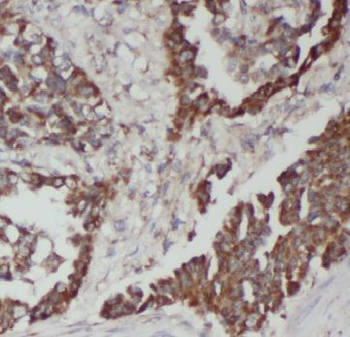 HCK Antibody