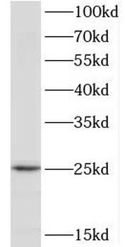 TPD52L1 Antibody
