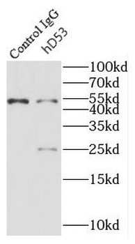 TPD52L1 Antibody