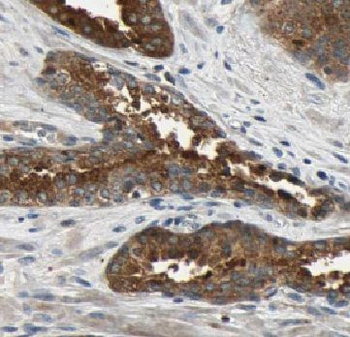 TPD52L1 Antibody