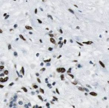 HDAC1 Antibody