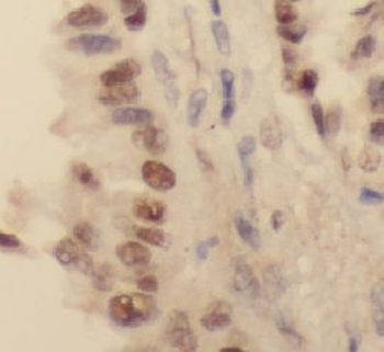 HDAC1 Mouse Monoclonal Antibody