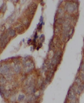 HDAC10 Antibody