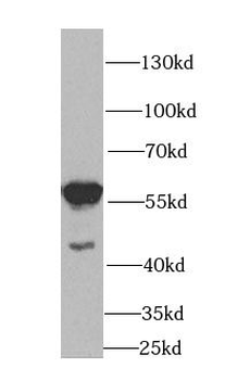 HDAC2 Rabbit Polyclonal Antibody