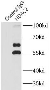 HDAC2 Rabbit Polyclonal Antibody
