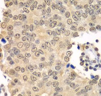 HDAC2 Rabbit Polyclonal Antibody