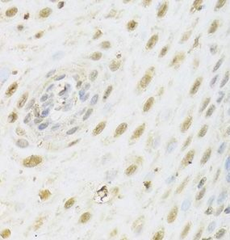 HDAC3 Rabbit Polyclonal Antibody
