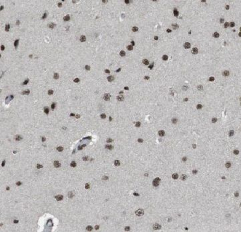 HDDC2 Antibody
