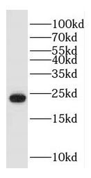 HDDC3 Antibody