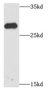 HDGFL3 Antibody