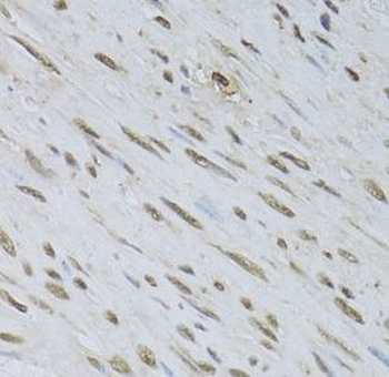 HDGFL3 Antibody