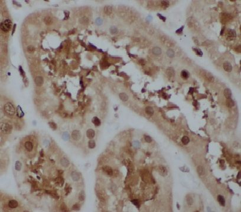 HECTD1 Antibody