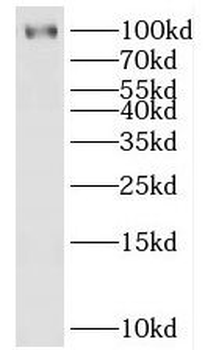 HECTD3 Antibody