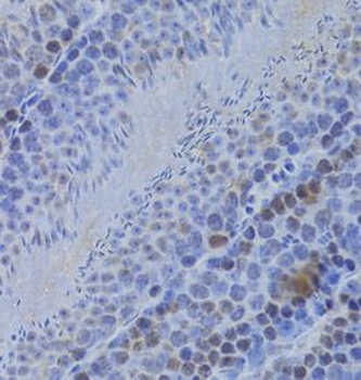 HELLS Antibody