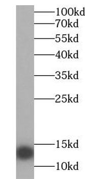 HBA1 Rabbit Polyclonal Antibody