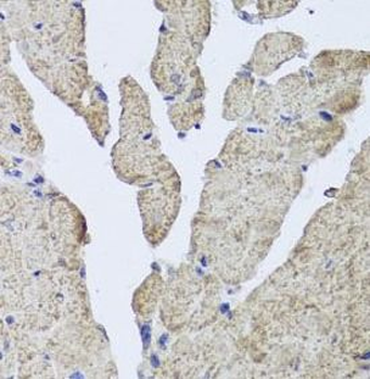 HBA1 Rabbit Polyclonal Antibody