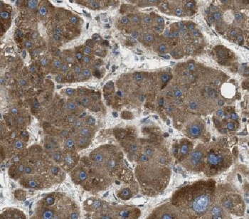HEPACAM Antibody