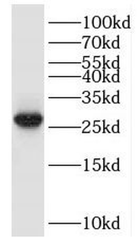 HPN Rabbit Polyclonal Antibody