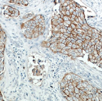 ERBB2 Rabbit Polyclonal Antibody