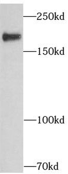 ERBB2 Rabbit Polyclonal Antibody