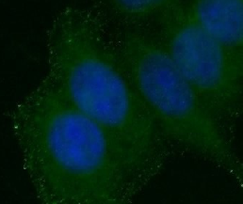 ERBB2 Rabbit Polyclonal Antibody
