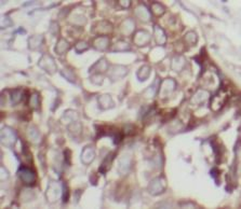 ERBB2 Rabbit Polyclonal Antibody